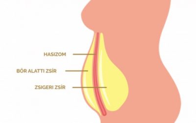 Mi is az a zsigeri zsír? Miért nem elég a hasizmozás a pocak megszüntetéséhez?